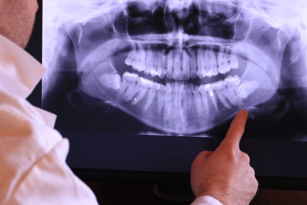 Best Emergency Treatment for Toothache in Montz, LA